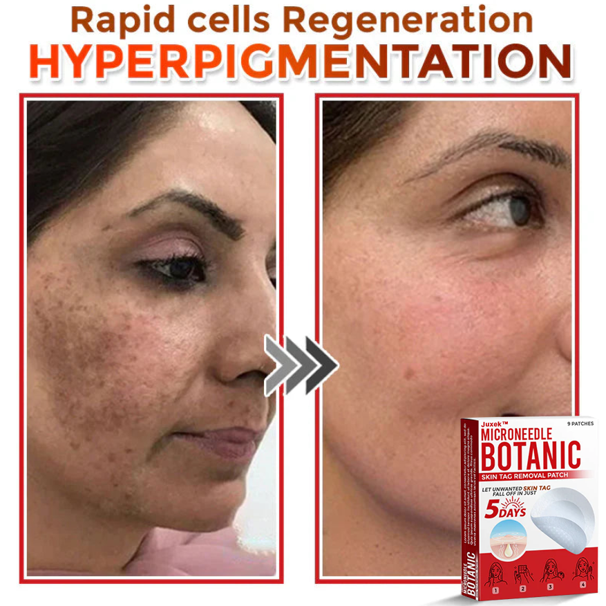 The QuickTag Removal Patch