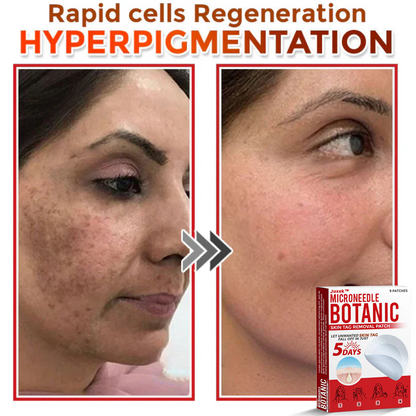 The QuickTag Removal Patch