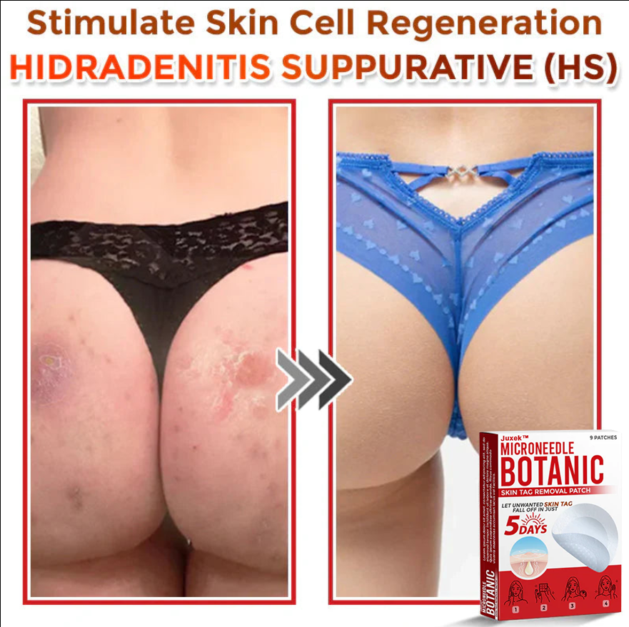 The QuickTag Removal Patch