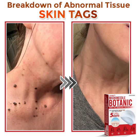 The QuickTag Removal Patch