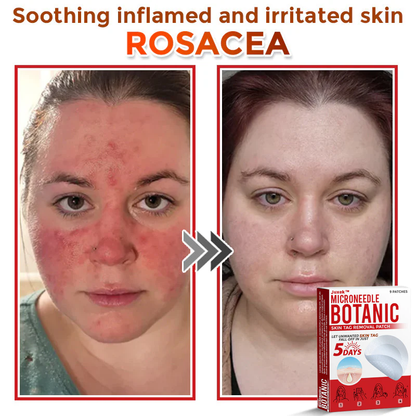 The QuickTag Removal Patch